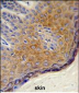 DERA Antibody (N-term)